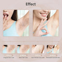 Salon Laser Epilator For Women At Home