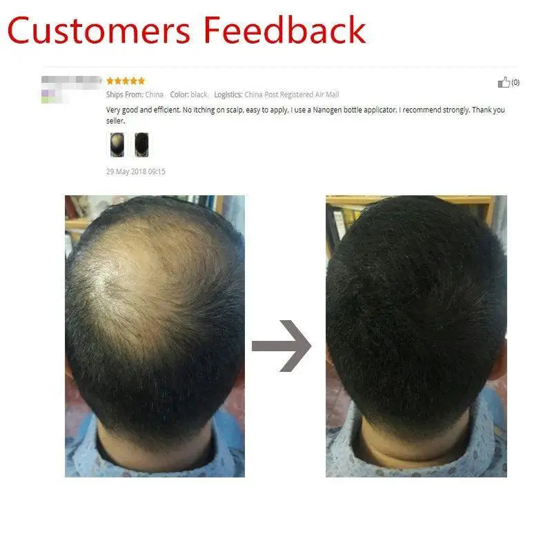 Sevich Hair Fiber Thicker Fuller Hair Building Solution