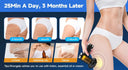 Smoother Skin Body Massager for Home Use