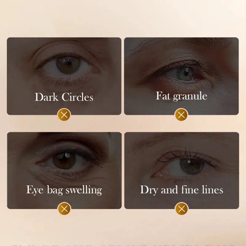 Snake Venom Eye Cream for Dark Circles