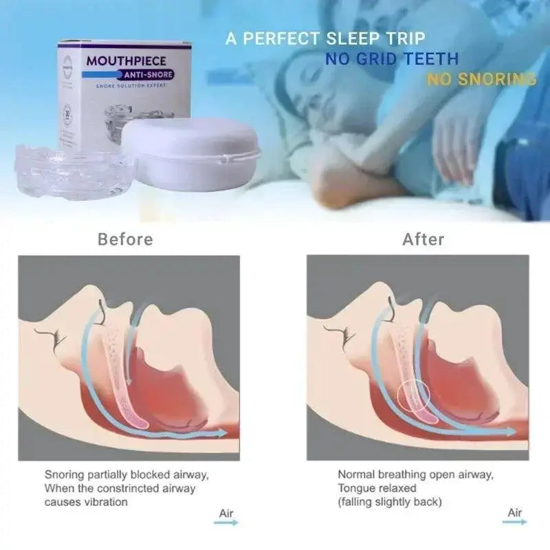 Snore Stopper Mouth Guard For Sleep Quality And Teeth Care