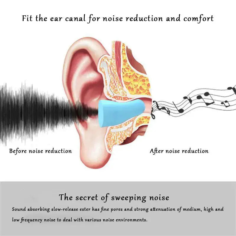 SoftSilence Noise Reduction Ear Plugs for Peaceful Sleep