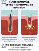 Swift Laser Hair Removal Device for Face