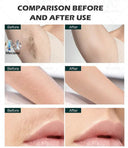 Swift Laser Hair Removal Device for Face