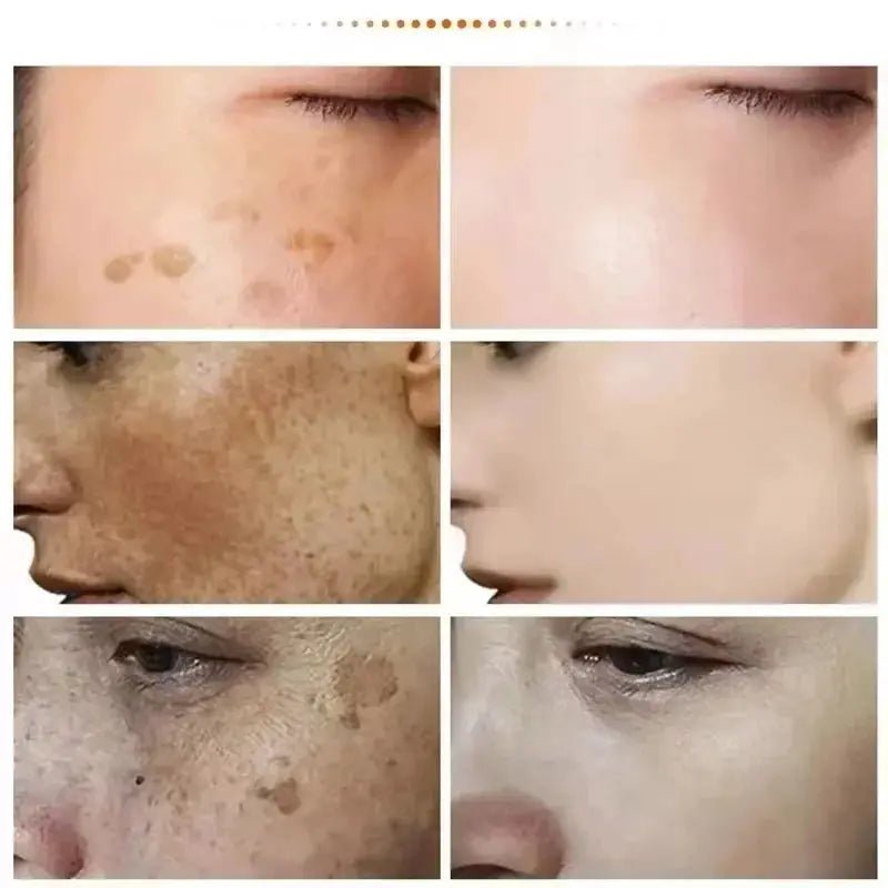 Spot Whitening Cream For Dark Spots