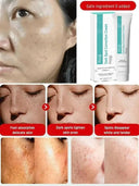 Spot Whitening Cream For Dark Spots