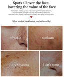 Spot Whitening Cream For Dark Spots