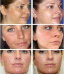 Spot Whitening Cream For Dark Spots