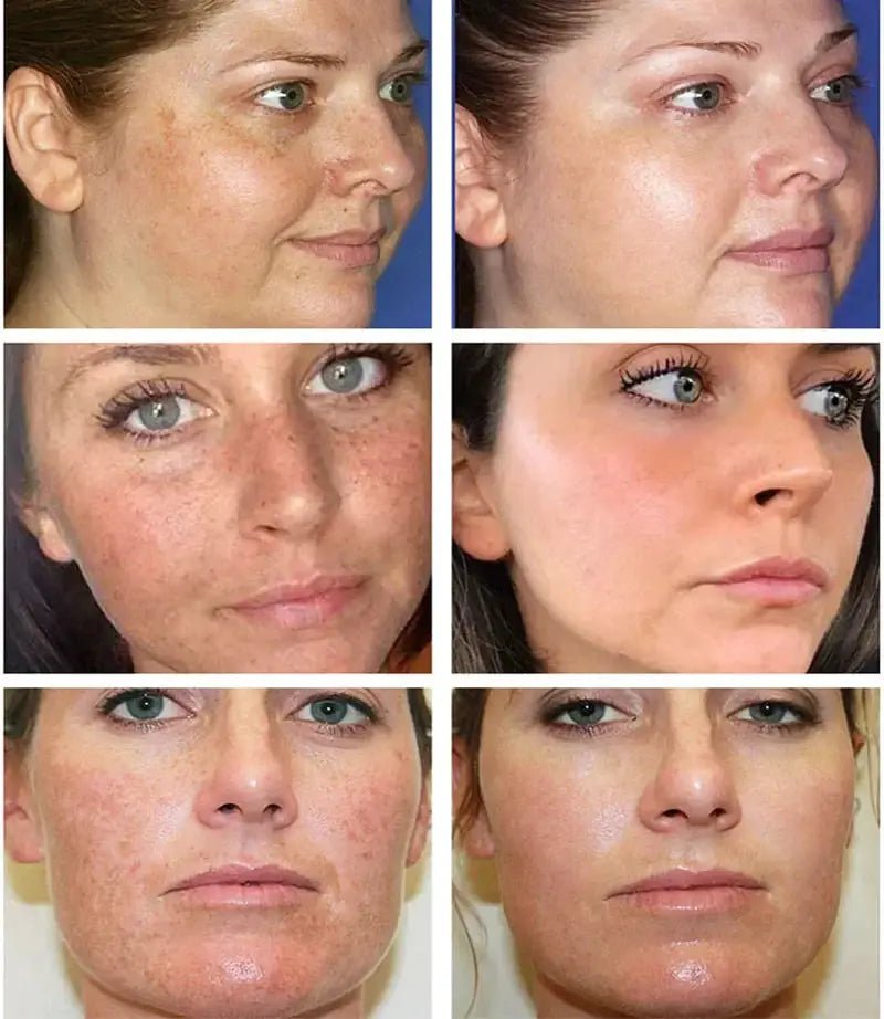 Spot Whitening Cream For Dark Spots