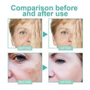 Spot Whitening Cream For Dark Spots