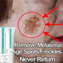 Spot Whitening Cream For Dark Spots