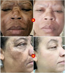 Spot Whitening Cream For Dark Spots