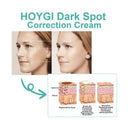 Spot Whitening Cream For Dark Spots