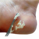 Stainless Steel Foot Scraper Professional Pedicure Tool for Smooth Feet