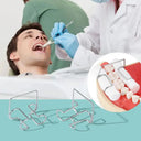 Secure Hold Orthodontic Clips for Clinic