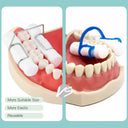 Secure Hold Orthodontic Clips for Clinic