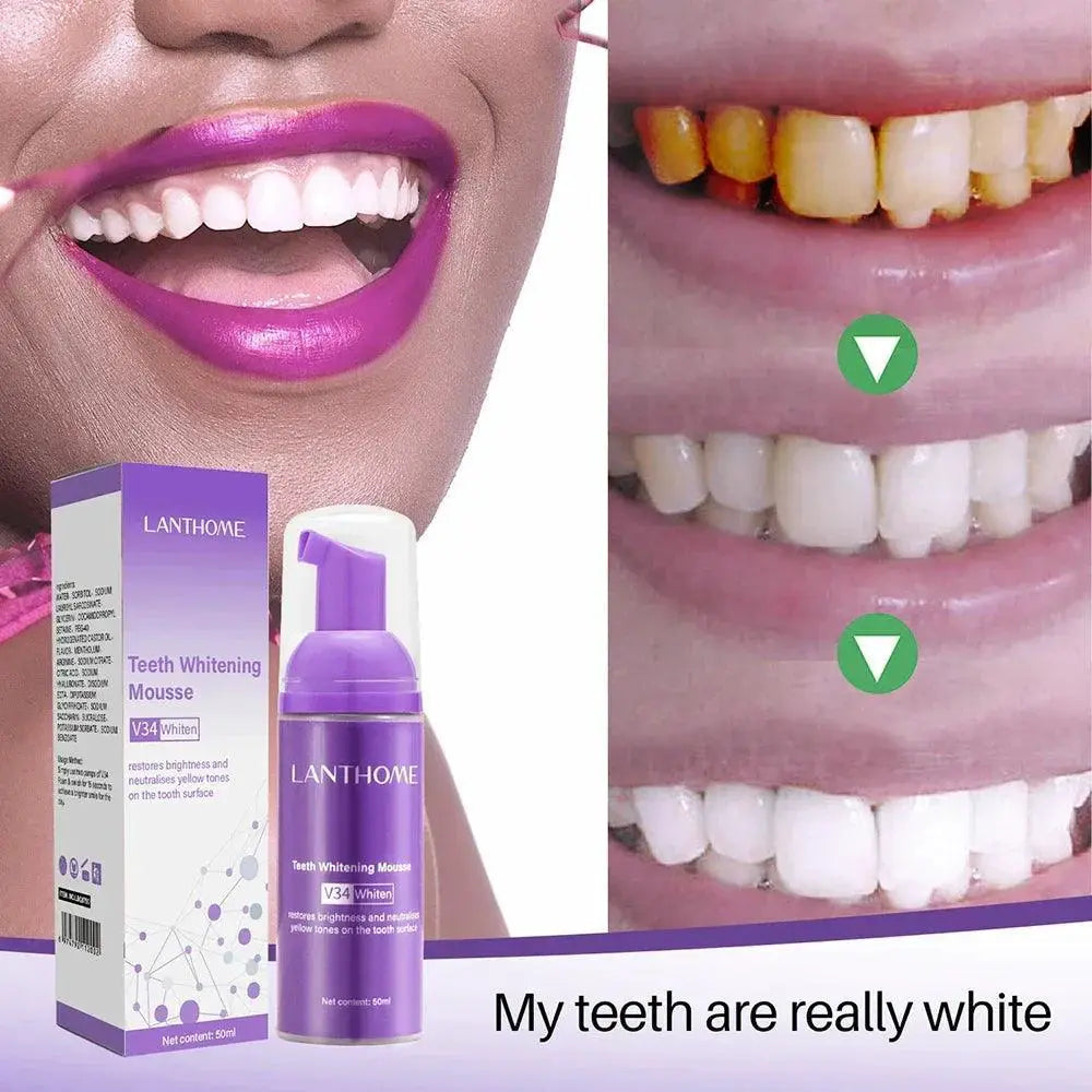 Teeth Whitening Mousse Deep Cleaning And Stain Repair