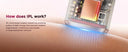 Totmizby IPL Hair Removal Device at Home