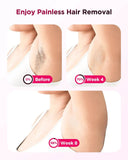 Totmizby IPL Hair Removal Device at Home
