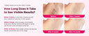 Totmizby IPL Hair Removal Device at Home
