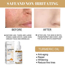Turmeric Skin Renewal Serum Brightening Anti-Aging Corrector
