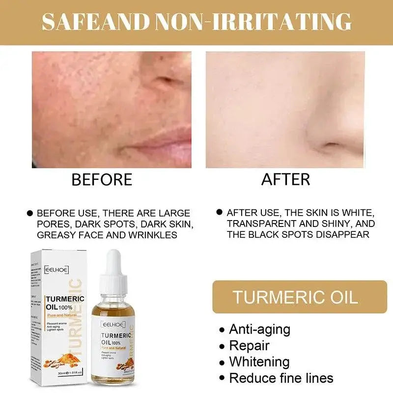 Turmeric Skin Renewal Serum Brightening Anti Aging Corrector