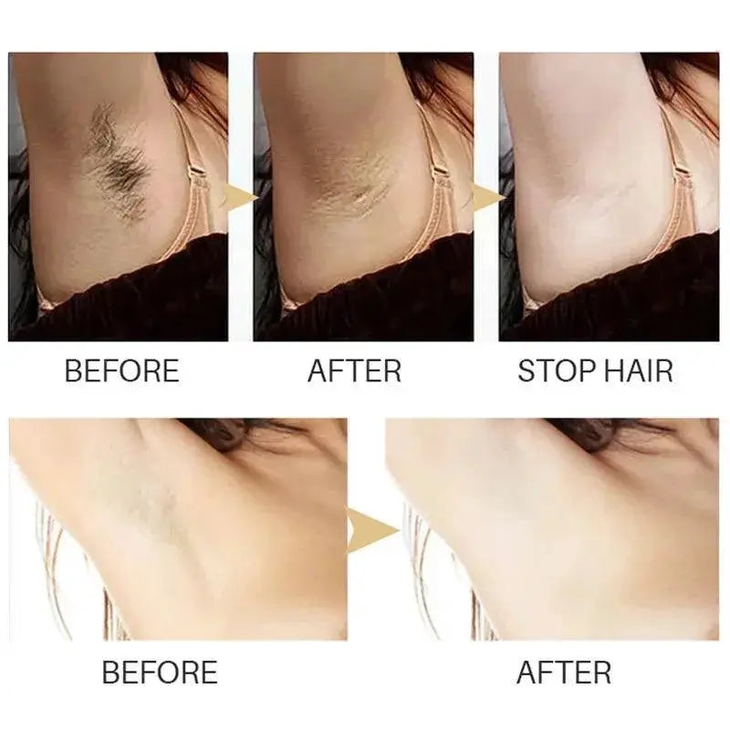 Ultimate Hair Growth Serum for Women Fast and Gentle