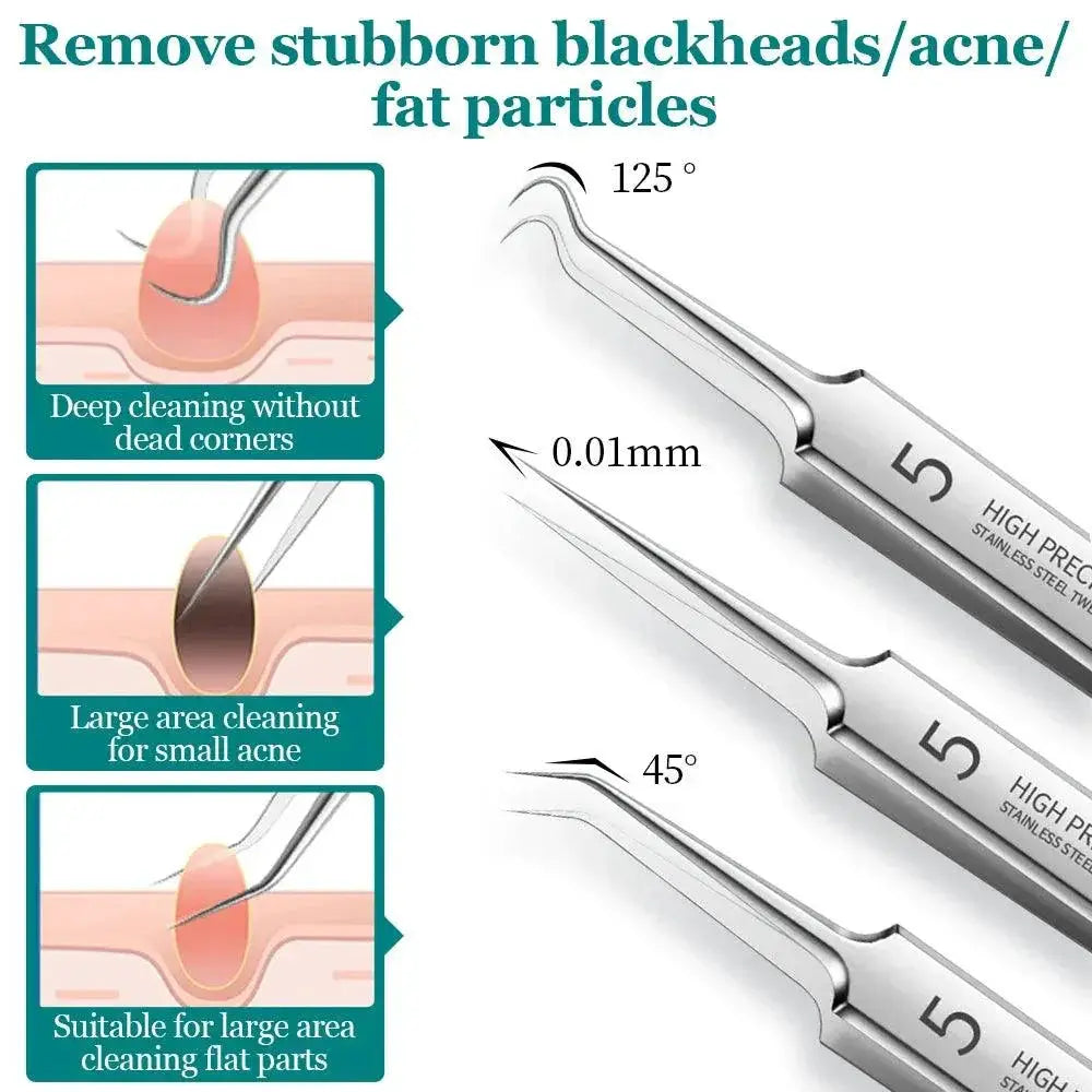 Ultimate Skin Care Kit Complete Blackhead And Acne Set