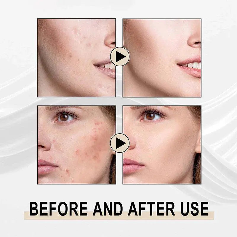 Skin Refining Hydrating Cream For Natural Transformation