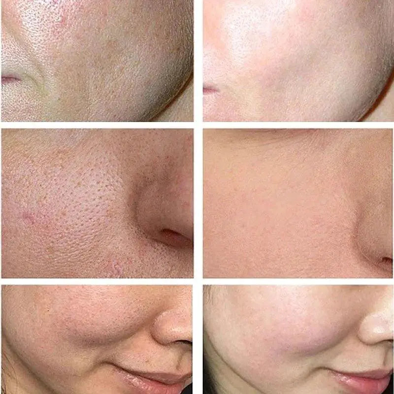 Skin Refining Hydrating Cream For Natural Transformation