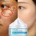 Whitening Freckles Cream for Melasma