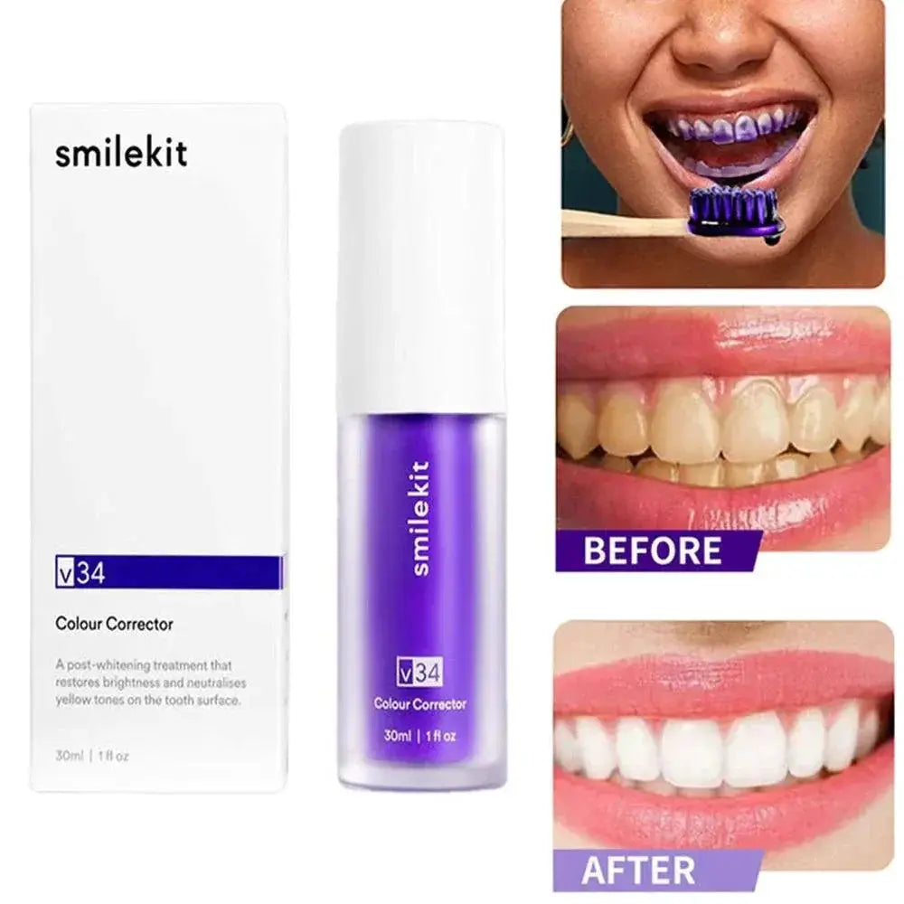 Whitening Toothpaste With Stain Removal For Bright Smiles