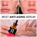 Youthful Radiance Skin Serum Diminish Wrinkles Hydrate
